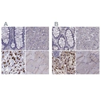 Immunohistochemical staining of human colon, liver, placenta and skeletal muscle using Anti-IKBIP antibody HPA038677 (A) shows similar protein distribution across tissues to independent antibody HPA038678 (B).