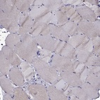 Immunohistochemical staining of human skeletal muscle shows low expression as expected.