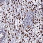 Immunohistochemical staining of human placenta shows high expression.