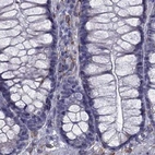 Immunohistochemical staining of human colon using Anti-IKBIP antibody HPA038677.