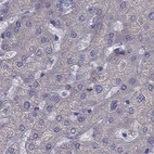 Immunohistochemical staining of human liver using Anti-IKBIP antibody HPA038677.