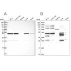 Western blot analysis using Anti-IKBIP antibody HPA038677 (A) shows similar pattern to independent antibody HPA038678 (B).