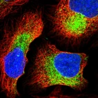 Immunofluorescent staining of human cell line U-2 OS shows localization to endoplasmic reticulum.