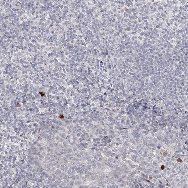 Anti-LY6G5C Antibody