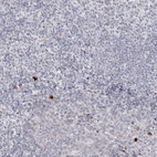 Anti-LY6G5C Antibody