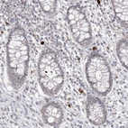 Immunohistochemical staining of human colon shows strong cytoplasmic positivity in a small subset of lymphoid cells.