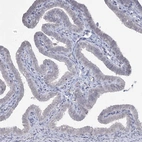 Immunohistochemical staining of human fallopian tube shows no positivity in glandular cells as expected.