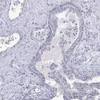 Immunohistochemical staining of human prostate shows no positivity in glandular cells as expected.