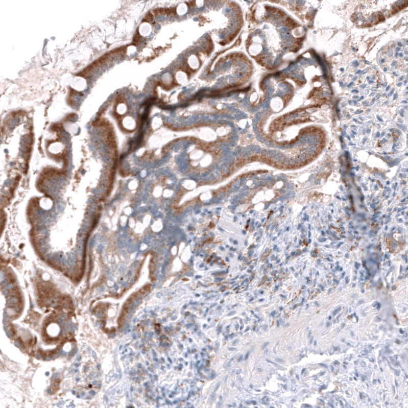 Anti-OSBPL5 Antibody
