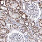 Anti-OSBPL5 Antibody
