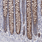 Immunohistochemical staining of human colon shows strong granular cytoplasmic positivity in glandular cells.