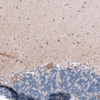 Immunohistochemical staining of human cerebellum shows moderate granular cytoplasmic positivity in Purkinje cells.