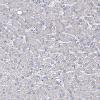 Immunohistochemical staining of human liver shows low positivity in hepatocytes as expected.