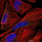 Immunofluorescent staining of human cell line U-2 OS shows localization to vesicles.