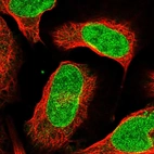 Immunofluorescent staining of human cell line U-2 OS shows localization to nucleoplasm & nuclear membrane.
