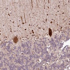Anti-ALKBH8 Antibody