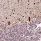 Anti-ALKBH8 Antibody