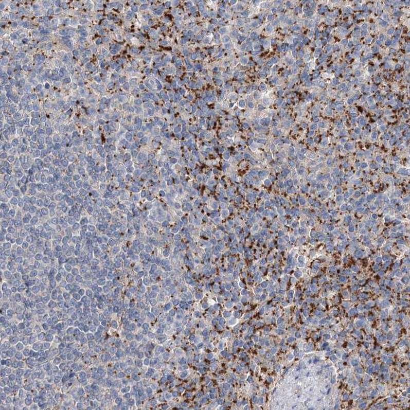 Anti-ALKBH8 Antibody
