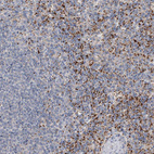 Anti-ALKBH8 Antibody