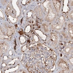Immunohistochemical staining of human kidney shows strong membranous positivity in cells in tubules.