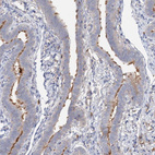 Immunohistochemical staining of human Fallopian tube shows moderate membranous positivity in glandular cells.