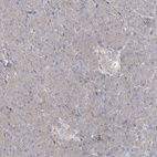 Immunohistochemical staining of human pancreas shows low positivity in endocrine glandular cells as expected.