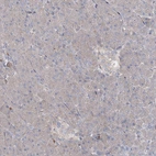 Immunohistochemical staining of human pancreas shows low positivity in endocrine glandular cells as expected.