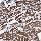 Anti-EYA4 Antibody