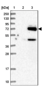 Lane 1: Marker [kDa] 250, 130, 95, 72, 55, 36, 28, 17, 10_br/_Lane 2: Human cell line RT-4_br/_Lane 3: Human cell line U-251MG sp