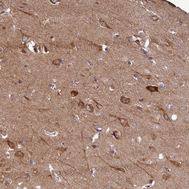 Anti-FUNDC1 Antibody