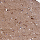 Anti-FUNDC1 Antibody