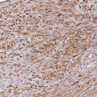 Immunohistochemical staining of human prostate shows moderate to strong cytoplasmic positivity in smooth muscle cells.