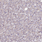 Immunohistochemical staining of human liver shows no positivity in hepatocytes as expected.