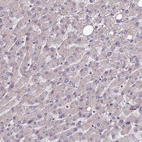 Immunohistochemical staining of human liver shows no positivity in hepatocytes as expected.