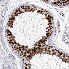 Anti-PSPC1 Antibody