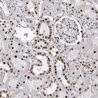 Anti-PSPC1 Antibody