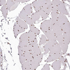 Anti-PSPC1 Antibody