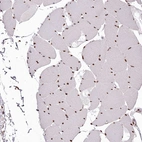 Immunohistochemical staining of human skeletal muscle shows nuclear positivity in myocytes.