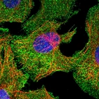Immunofluorescent staining of human cell line U-2 OS shows localization to plasma membrane & cytosol.