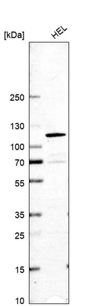 Western blot analysis in human cell line HEL.