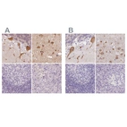 Immunohistochemical staining of human cerebellum, cerebral cortex, lymph node and pancreas using Anti-MAP1A antibody HPA039063 (A) shows similar protein distribution across tissues to independent antibody HPA039064 (B).