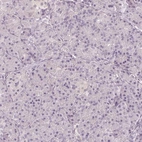 Immunohistochemical staining of human pancreas shows low expression as expected.
