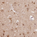 Immunohistochemical staining of human cerebral cortex shows high expression.
