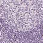 Immunohistochemical staining of human lymph node using Anti-MAP1A antibody HPA039063.