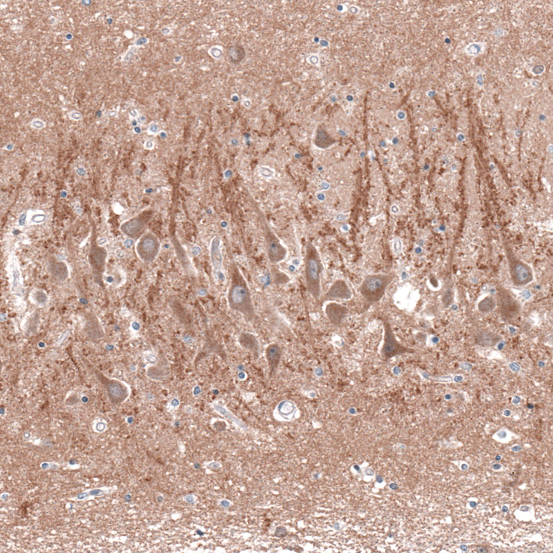 Anti-CACNA1H Antibody