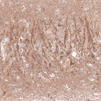 Anti-CACNA1H Antibody