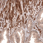 Immunohistochemical staining of human prostate shows moderate to strong membranous and cytoplasmic positivity in smooth muscle cells.