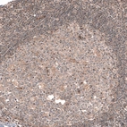Immunohistochemical staining of human tonsil shows only very weak positivity in lymphoid cells.