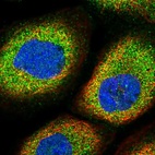 Immunofluorescent staining of human cell line A-431 shows localization to cytosol.