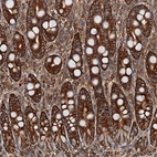 Anti-USP6NL Antibody